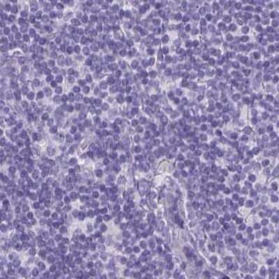 Immunohistochemistry-Paraffin: PLC-beta 3 Antibody [NBP2-32026] - Staining of human lymph node.