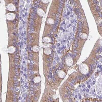 Immunohistochemistry-Paraffin: PLC-beta 3 Antibody [NBP2-32026] - Staining of human duodenum.