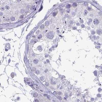 Immunohistochemistry-Paraffin: PLC-beta 3 Antibody [NBP2-32026] - Staining of human testis.