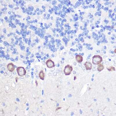 Immunohistochemistry-Paraffin: PLC-beta 3 Antibody [NBP2-93347] - Immunohistochemistry of paraffin-embedded rat brain using PLC-beta 3 Rabbit pAb (NBP2-93347) at dilution of 1:100 (40x lens). Perform high pressure antigen retrieval with 10 mM citrate buffer pH 6.0 before commencing with IHC staining protocol.