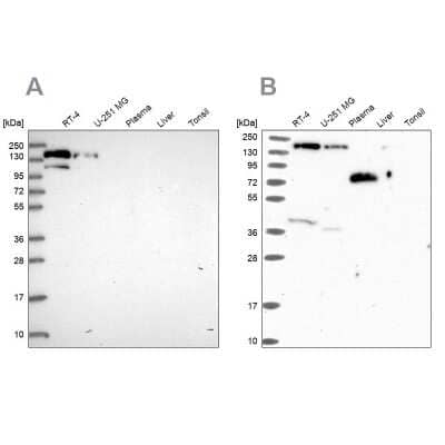 Western Blot: PLC-beta 3 Antibody [NBP2-32026] - Analysis using Anti-PLCB3 antibody NBP2-32026 (A) shows similar pattern to independent antibody NBP2-31974 (B).