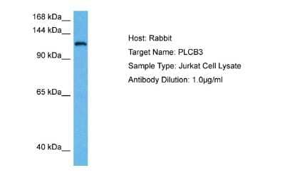 Western Blot: PLC-beta 3 Antibody [NBP2-88061] - Host: Rabbit. Target Name: PLCB3. Sample Tissue: Human Jurkat Whole Cell lysates. Antibody Dilution: 1ug/ml