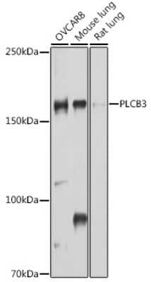 Western Blot: PLC-beta 3 Antibody [NBP2-93347] - Analysis of extracts of various cell lines, using PLC-beta 3 at 1:1000 dilution. Secondary antibody: HRP Goat Anti-Rabbit IgG (H+L) at 1:10000 dilution. Lysates/proteins: 25ug per lane. Blocking buffer: 3% nonfat dry milk in TBST. Detection: ECL Basic Kit . Exposure time: 30s.