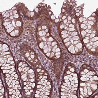 Immunohistochemistry-Paraffin: PLC-delta 3 Antibody [NBP2-68706] - Staining of human colon shows strong cytoplasmic positivity in glandular cells.