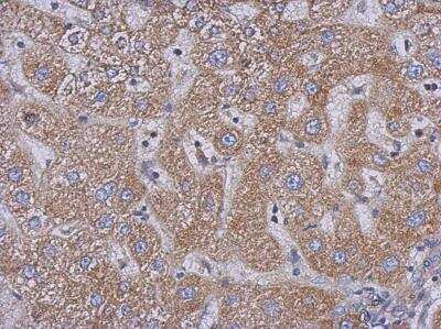 Immunohistochemistry-Paraffin: PLC-delta 3 Antibody [NBP2-19862] - Human hepatoma, using PLCD3  antibody at 1:500 dilution. Antigen Retrieval: Trilogy™ (EDTA based, pH 8.0) buffer, 15min.