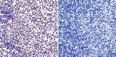 Immunohistochemistry-Paraffin: PLC-gamma 1 Antibody (2C11) [NB100-74517] - Normal biopsies of deparaffinized human tonsil tissue.