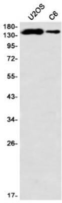 Western Blot: PLC-gamma 1 Antibody (S01-6B4) [NBP3-20073] - Western blot detection of PLC-gamma 1 in U2OS, C6 using NBP3-20073 (1:1000 diluted)