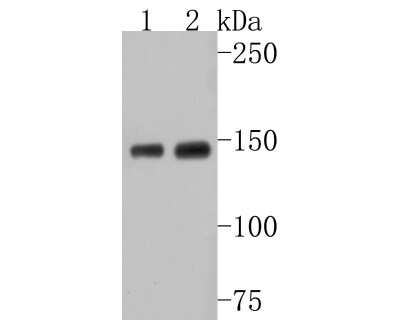 Western Blot: PLC-gamma 1 Antibody (SN06-10) [NBP2-67661] - Analysis of PLC-gamma 1 on different lysates. Proteins were transferred to a PVDF membrane and blocked with 5% BSA in PBS for 1 hour at room temperature. The primary antibody (1/500) was used in 5% BSA at room temperature for 2 hours. Goat Anti-Rabbit IgG - HRP Secondary Antibody at 1:200,000 dilution was used for 1 hour at room temperature.Positive control: Lane 1: MCF-7 cell lysateLane 2: SH-SY5Y cell lysate