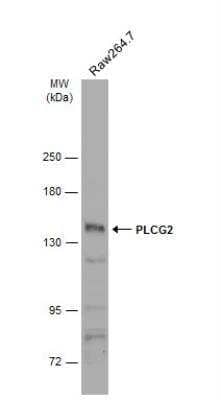 Western Blot: PLC-gamma 2 Antibody [NBP1-33122] - Whole cell extract (30 ug) was separated by 5% SDS-PAGE, and the membrane was blotted with PLCG2 antibody [N1N2], N-term diluted at 1:500. The HRP-conjugated anti-rabbit IgG antibody (NBP2-19301) was used to detect the primary antibody.