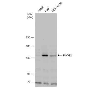 Western Blot: PLC-gamma 2 Antibody [NBP1-33122] - Various whole cell extracts (30 ug) were separated by 5% SDS-PAGE, and the membrane was blotted with PLCG2 antibody [N1N2], N-term diluted at 1:500. The HRP-conjugated anti-rabbit IgG antibody (NBP2-19301) was used to detect the primary antibody.