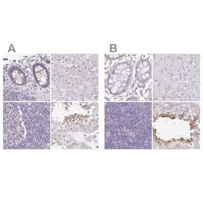 Immunohistochemistry-Paraffin: PLCD4 Antibody [NBP2-38392] - Staining of human colon, liver, lymph node and testis using Anti-PLCD4 antibody NBP2-38392 (A) shows similar protein distribution across tissues to independent antibody NBP2-38393 (B).