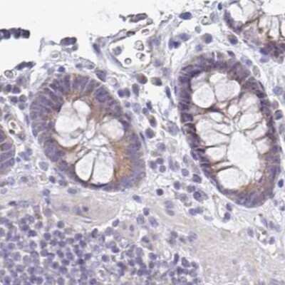 Immunohistochemistry-Paraffin: PLCD4 Antibody [NBP2-38392] - Staining of human colon.