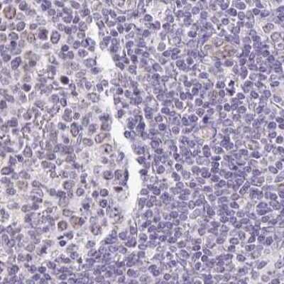 Immunohistochemistry-Paraffin: PLCD4 Antibody [NBP2-38392] - Staining of human lymph node.
