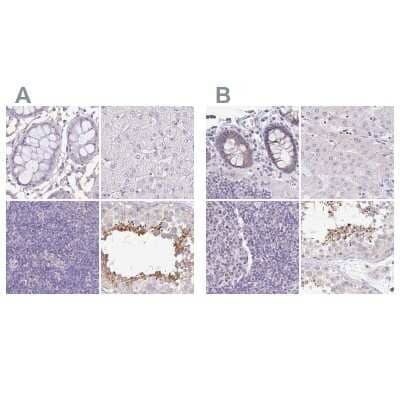 <b>Independent Antibodies Validation. </b>Immunohistochemistry-Paraffin: PLCD4 Antibody [NBP2-38393] - Staining of human colon, liver, lymph node and testis using Anti-PLCD4 antibody NBP2-38393 (A) shows similar protein distribution across tissues to independent antibody NBP2-38392 (B).