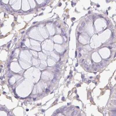 Immunohistochemistry-Paraffin: PLCD4 Antibody [NBP2-38393] - Staining of human colon.