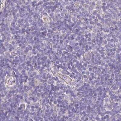 Immunohistochemistry-Paraffin: PLCD4 Antibody [NBP2-38393] - Staining of human lymph node.