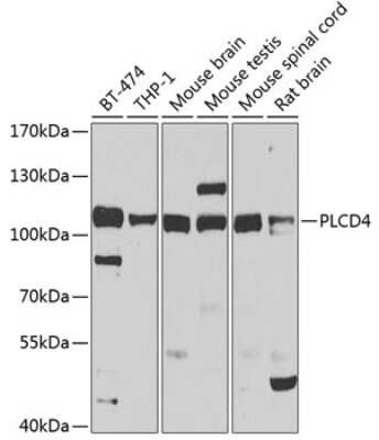 Western Blot: PLCD4 Antibody [NBP2-94312] - Analysis of extracts of various cell lines, using PLCD4 at 1:1000 dilution. Secondary antibody: HRP Goat Anti-Rabbit IgG (H+L) at 1:10000 dilution. Lysates/proteins: 25ug per lane. Blocking buffer: 3% nonfat dry milk in TBST. Detection: ECL Basic Kit . Exposure time: 30s.