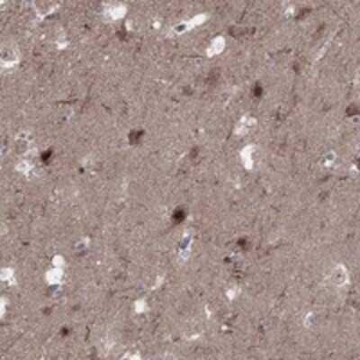 Immunohistochemistry-Paraffin: PLCL2 Antibody [NBP3-17912] - Staining of human hippocampus shows strong nuclear positivity in neuronal cells.