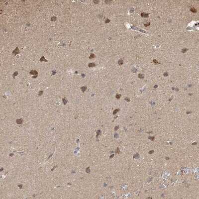 Immunohistochemistry-Paraffin: PLCL3 Antibody [NBP1-88009] - Staining of human cerebral cortex shows moderate cytoplasmic positivity in neuronal cells.