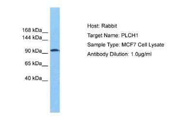 Western Blot: PLCL3 Antibody [NBP2-88062] - Host: Rabbit. Target Name: PLCH1. Sample Tissue: Human MCF7 Whole Cell. Antibody Dilution: 1.0ug/ml