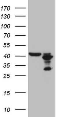 Western Blot: PLCXD1 Antibody (OTI2D7) - Azide and BSA Free [NBP2-73458] - Analysis of HEK293T cells were transfected with the pCMV6-ENTRY control (Left lane) or pCMV6-ENTRY PLCXD1.