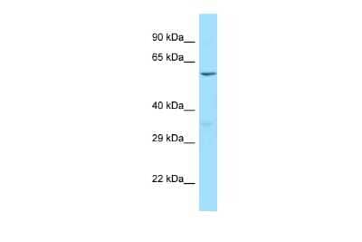 Western Blot: PLCXD1 Antibody [NBP2-88063] - WB Suggested Anti-PLCXD1 Antibody. Titration: 1.0 ug/ml. Positive Control: 721_B Whole CellPLCXD1 is supported by BioGPS gene expression data to be expressed in 721_B