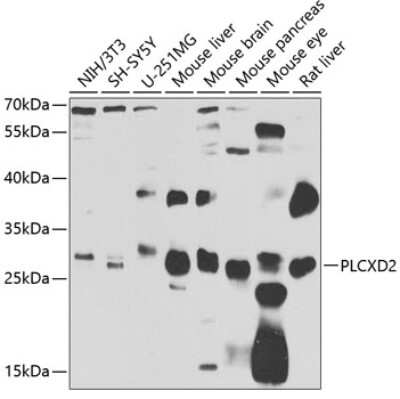 Western Blot: PLCXD2 Antibody [NBP2-93388] - Analysis of extracts of various cell lines, using PLCXD2 at 1:1000 dilution. Secondary antibody: HRP Goat Anti-Rabbit IgG (H+L) at 1:10000 dilution. Lysates/proteins: 25ug per lane. Blocking buffer: 3% nonfat dry milk in TBST. Detection: ECL Basic Kit . Exposure time: 90s.