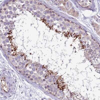 Immunohistochemistry-Paraffin: PLCXD3 Antibody [NBP2-13769] - Staining of human testis shows distinct cytoplasmic and nuclear positivity in subset of cells in seminiferus ducts.