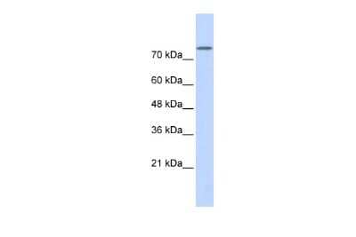 Western Blot: PLD2 Antibody [NBP3-09192] - Western blot analysis using NBP3-09192 on Transfected 293T  as a positive control. Antibody Titration: 0.2-1 ug/ml