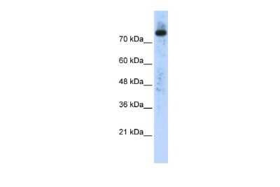 Western Blot: PLD2 Antibody [NBP3-09215] - Western blot analysis using NBP3-09215 on Transfected 293T  as a positive control. Antibody Titration: 0.2-1 ug/ml