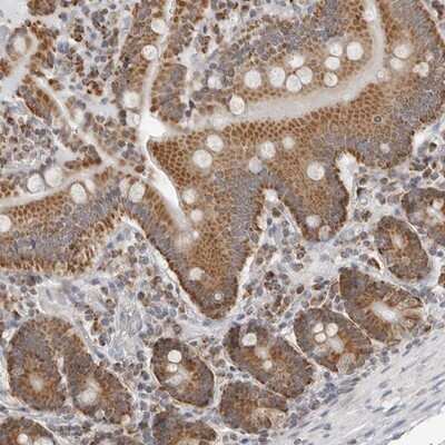 Immunohistochemistry-Paraffin: PLD5 Antibody [NBP1-81911] - Staining of human duodenum shows distinct granular cytoplasmic positivity in glandular cells.