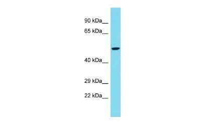 Western Blot: PLD5 Antibody [NBP2-85489] - Host: Rabbit. Target Name: PLD5. Sample Type: Fetal Heart lysates. Antibody Dilution: 1.0ug/ml
