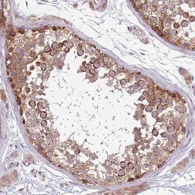 Immunohistochemistry-Paraffin: PLD6 Antibody [NBP2-13771] Staining of human testis shows strong cytoplasmic positivity in cells in seminiferus ducts.
