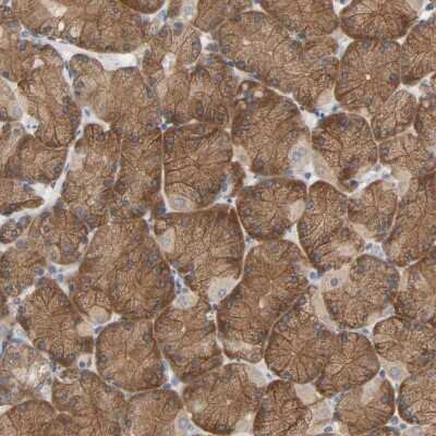 Immunohistochemistry-Paraffin PLEKHA2 Antibody