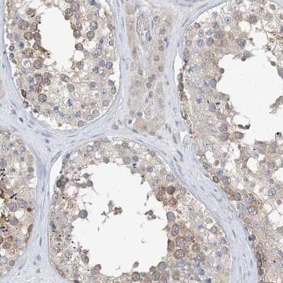 Immunohistochemistry-Paraffin PLEKHA3 Antibody - BSA Free