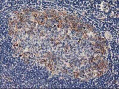 Immunohistochemistry PLEKHA3 Antibody (OTI5D11) - Azide and BSA Free