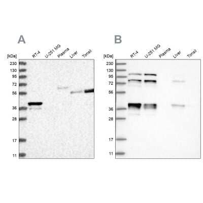 Western Blot: PLEKHA3 Antibody [NBP1-83924] - Analysis using Anti-PLEKHA3 antibody NBP1-83924 (A) shows similar pattern to independent antibody NBP2-32018 (B).