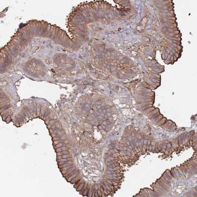 Immunohistochemistry-Paraffin PLEKHA4 Antibody