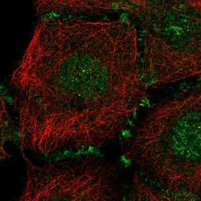 Immunocytochemistry/Immunofluorescence: PLEKHA7 Antibody [NBP2-68835] - Staining of human cell line HaCaT shows localization to nucleus & cell junctions.