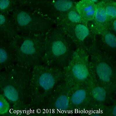 Immunocytochemistry/Immunofluorescence: PLEKHA7 Antibody [NBP2-76328] - A431 cells were fixed for 10 minutes using 10% formalin and then permeabilized for 5 minutes using 1X PBS + 0.05% Triton-X100. The cells were incubated with anti-PLEKHA7 Antibody at 5 ug/ml overnight at 4C and detected with an anti-rabbit Dylight 488 (Green) at a 1:500 dilution. Nuclei were counterstained with DAPI (Blue). Cells were imaged using a 40X objective. 