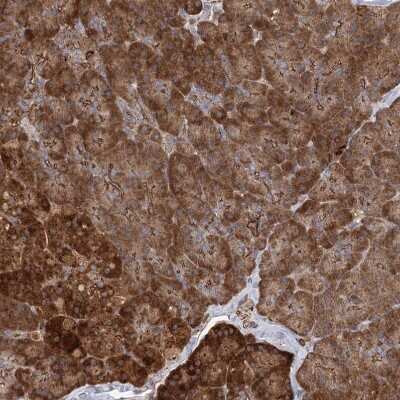 Immunohistochemistry-Paraffin: PLEKHA7 Antibody [NBP1-85045] - Staining of human pancreas shows strong cytoplasmic positivity in exocrine glandular cells and in islets of Langerhans.