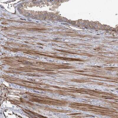 Immunohistochemistry-Paraffin: PLEKHA7 Antibody [NBP1-85045] - Staining of human prostate shows moderate to strong cytoplasmic positivity in smooth muscle cells.