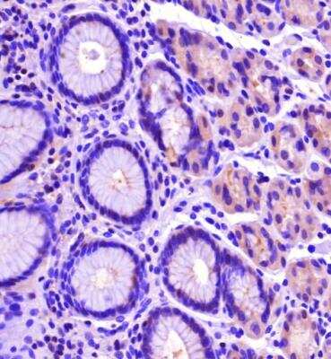 Immunohistochemistry-Paraffin: PLEKHA7 Antibody [NBP2-76328] -  IHC analysis of a formalin fixed paraffin embedded tissue section of human stomach using PLEKHA7 (NBP2-76328) antibody at 1:200 dilution. The staining was developed using HRP-DAB detection method and the nuclei were counterstained with hematoxylin. 