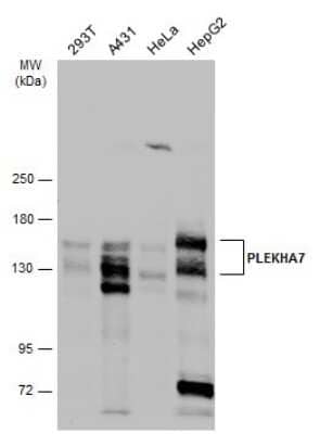 Western Blot: PLEKHA7 Antibody [NBP3-12994] - Various whole cell extracts (30 ug) were separated by 5% SDS-PAGE, and the membrane was blotted with PLEKHA7 antibody (NBP3-12994) diluted at 1:500. The HRP-conjugated anti-rabbit IgG antibody (NBP2-19301) was used to detect the primary antibody.