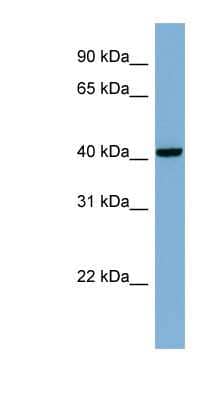 Western Blot: PLEKHA9 Antibody [NBP1-70675] - MCF-7 whole cell lysates, concentration 0.2-1 ug/ml.