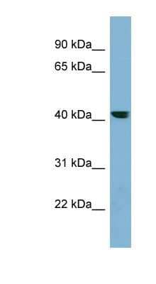 Western Blot: PLEKHA9 Antibody [NBP1-70676] - PANC1 cell lysate, concentration 0.2-1 ug/ml.