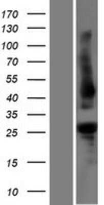 Western Blot: PLEKHB1/PHR1 Overexpression Lysate (Adult Normal) [NBP2-06551] Left-Empty vector transfected control cell lysate (HEK293 cell lysate); Right -Over-expression Lysate for PLEKHB1/PHR1.