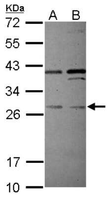 Western Blot PLEKHF2 Antibody