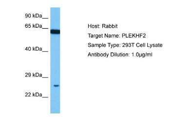Western Blot: PLEKHF2 Antibody [NBP2-85491] - Host: Rabbit. Target Name: PLEKHF2. Sample Tissue: Human 293T Whole Cell lysates. Antibody Dilution: 1ug/ml