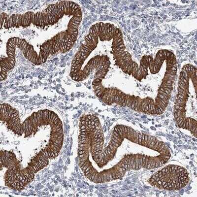 Immunohistochemistry-Paraffin: PLEKHG4B Antibody [NBP1-93566] - Staining of human corpus, uterine shows strong cytoplasmic positivity in glandular cells.